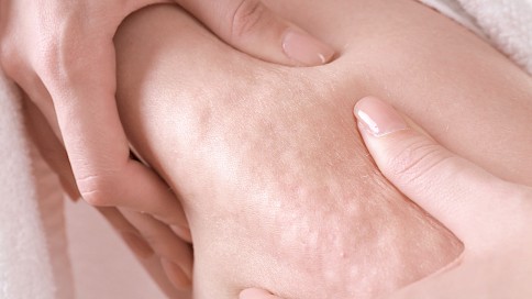Fluid retention